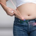 All You Need to Know About Laser Liposuction