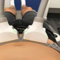 Understanding Laser Lipolysis (SculpSure) for Non-Surgical Body Contouring