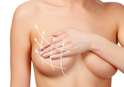 Breast Augmentation: Enhancing Your Body Shape in Los Angeles