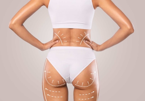 The Brazilian Butt Lift: A Comprehensive Guide to Body Contouring in Los Angeles