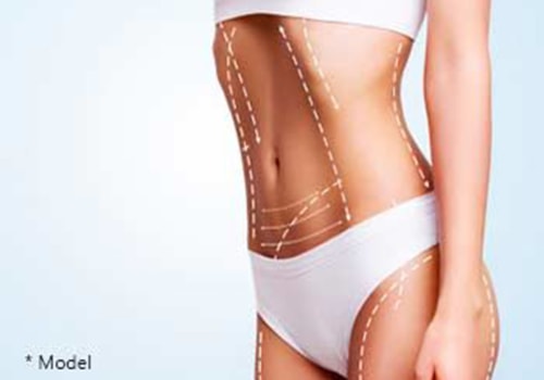 Boosting Self-Confidence: The Benefits of Liposuction in Los Angeles