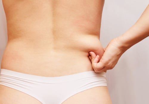 Managing Pain and Discomfort After Liposuction in Los Angeles