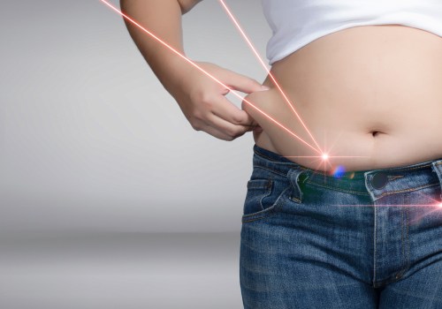 All You Need to Know About Laser Liposuction