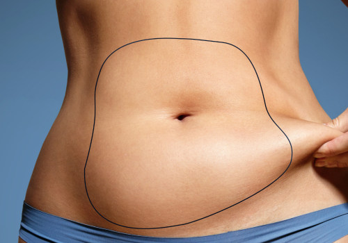 All You Need to Know About Abdominal Liposuction