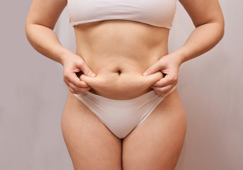 Preparing for Liposuction Recovery: A Comprehensive Guide